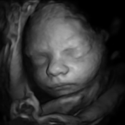 AI generated image of a baby from a 3d ultrasound photo